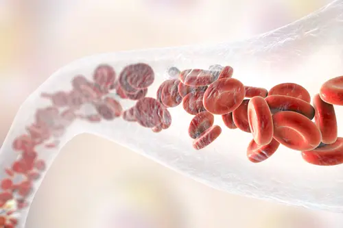 Vascular-Surgery